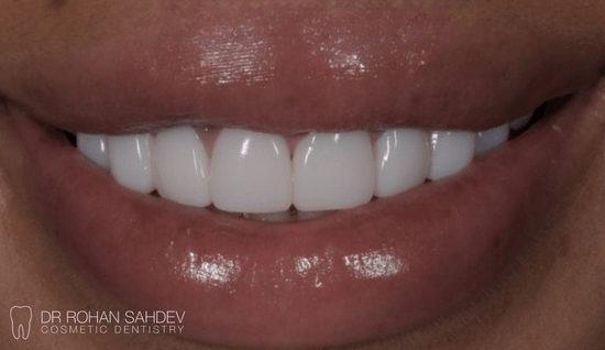 After - Rohan Sahdev