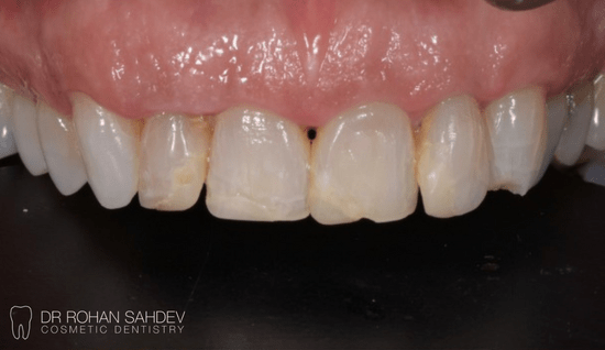 Before - Rohan Sahdev