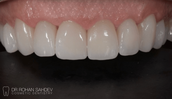 After - Rohan Sahdev