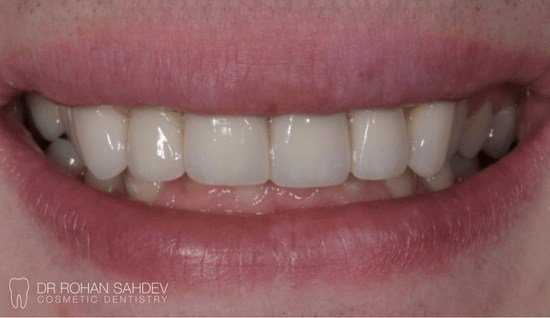 After - Rohan Sahdev