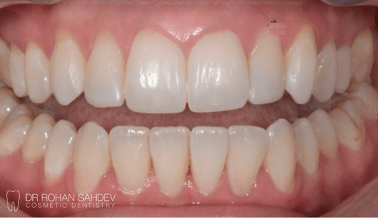 After - Rohan Sahdev