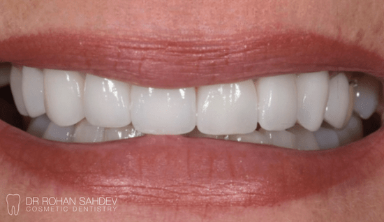 After - Rohan Sahdev