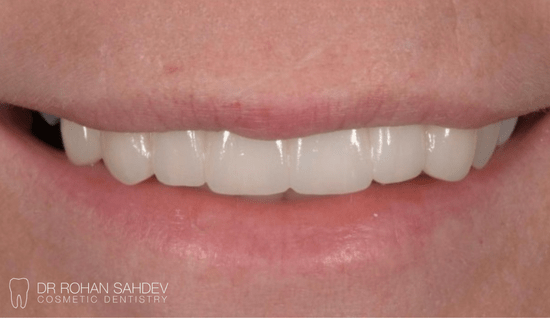 After - Rohan Sahdev