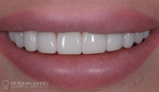 After - Rohan Sahdev