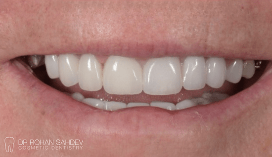 After - Rohan Sahdev