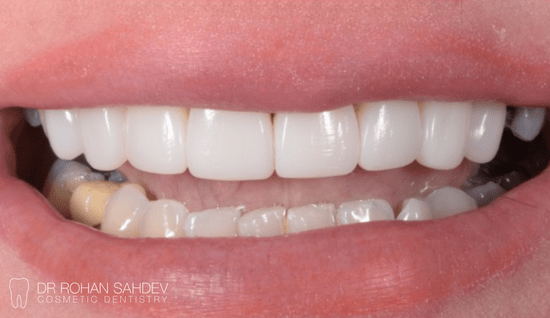 After - Rohan Sahdev