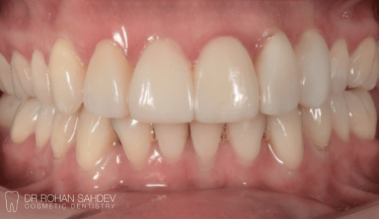 After - Rohan Sahdev