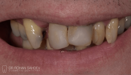 Before - Rohan Sahdev