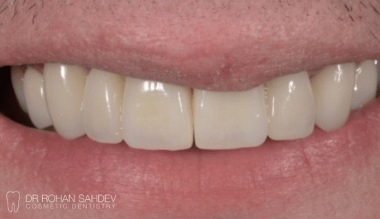 After - Rohan Sahdev