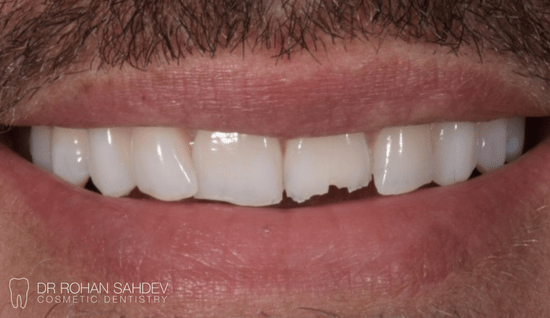 Before - Rohan Sahdev