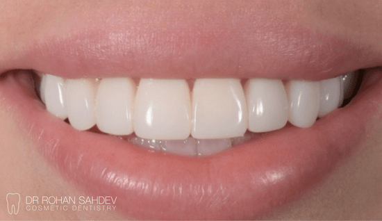 After - Rohan Sahdev