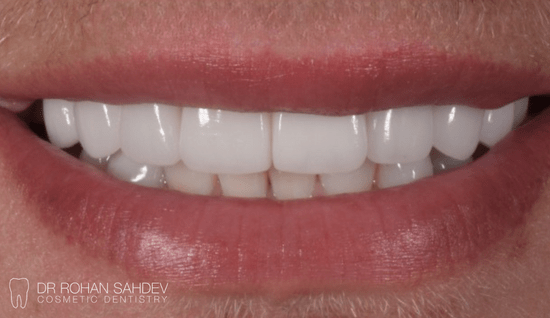 After - Rohan Sahdev