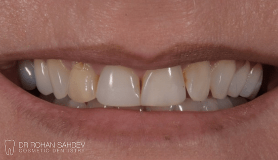 Before - Rohan Sahdev