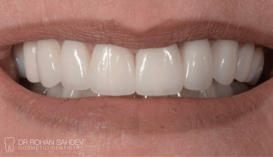 After - Rohan Sahdev