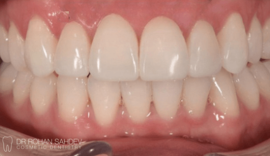 After - Rohan Sahdev