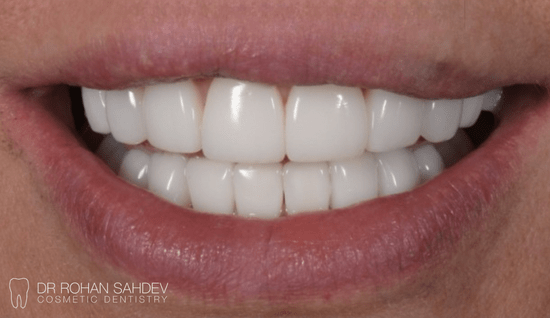 After - Rohan Sahdev