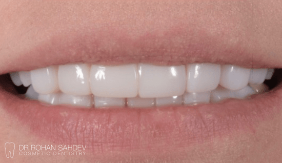 After - Rohan Sahdev