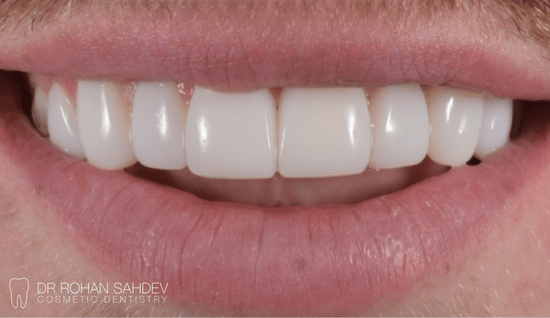 After - Rohan Sahdev