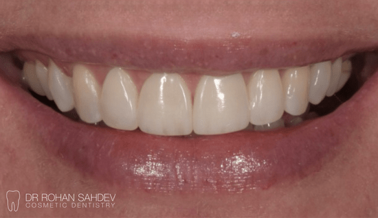 After - Rohan Sahdev